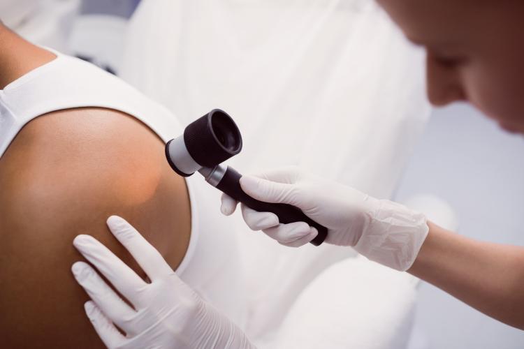 doctor-removing-mole-with-laser-treatment.jpg