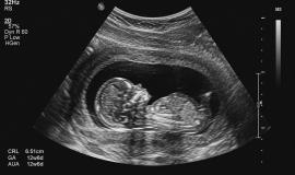 2026-06-16 9.57.02 AM.jpg