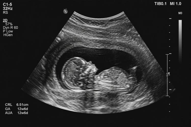 2026-06-16 9.57.02 AM.jpg